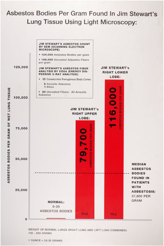 Asbestos Bodies